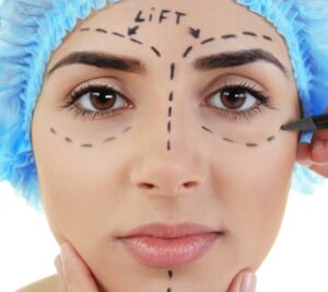Eyelid Elegance: Balancing the Beauty and Pain of Surgery 3 QC Browlift 1024x910 1