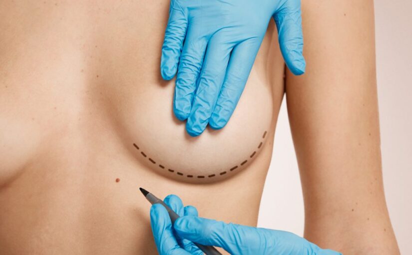 The Empowering Benefits of Breast Enhancement Surgery 1 breast lift scars 1024x683 1