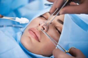 Symphony of Healing: A Step-by-Step Guide to Rhinoplasty Recovery 2 what to know rhinoplasty Large 1