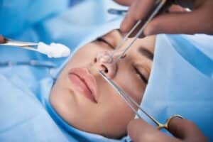 what to know rhinoplasty Large