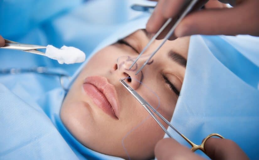 what to know rhinoplasty Large