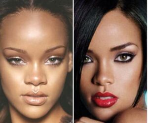 Empowering Identity: The Impact of Rhinoplasty on African American Features 2 5f06123df60c608ace689184cdfbfc0d