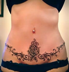 Single Rose Tummy Tuck Tattoo 974x1024 1